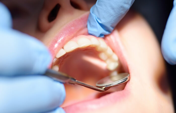 Endodontic treatment