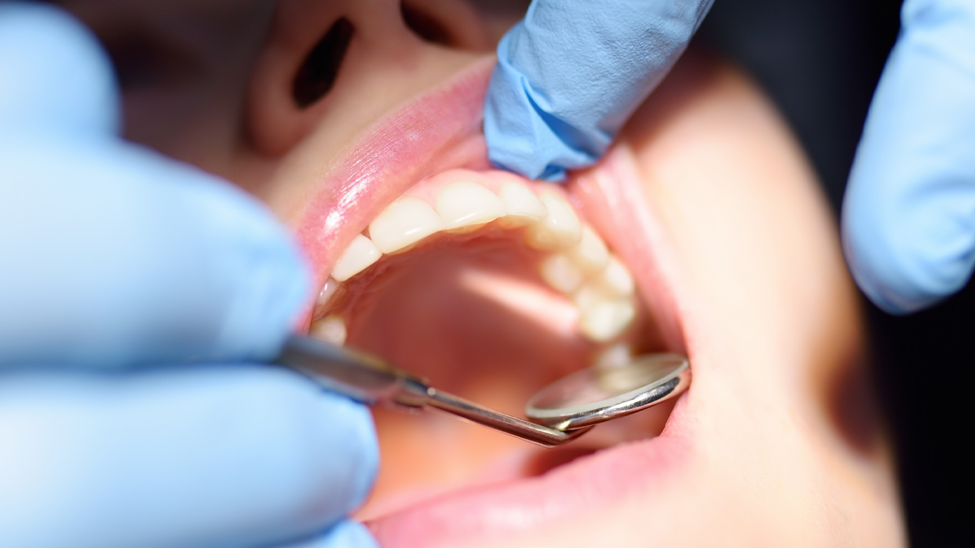 Endodontic treatment