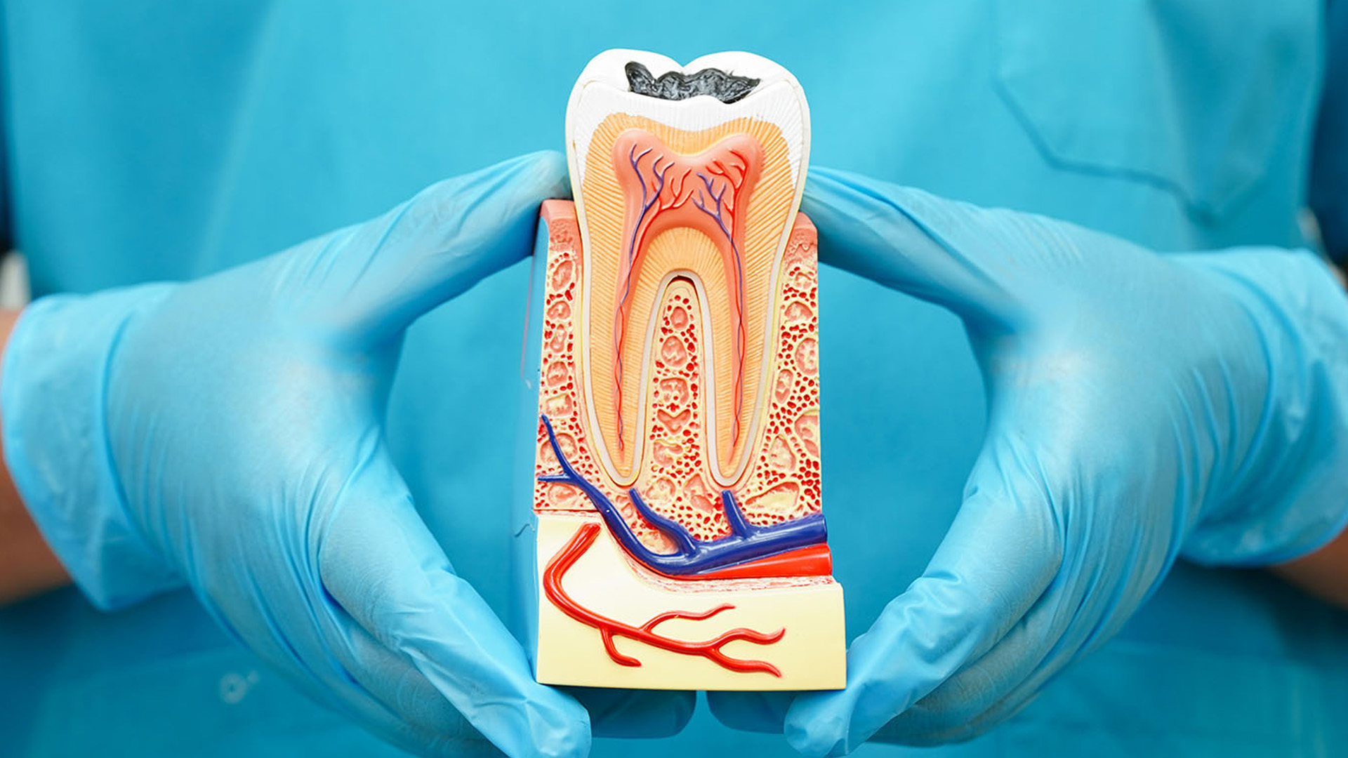 How Do You Know If A Root Canal Is Failing