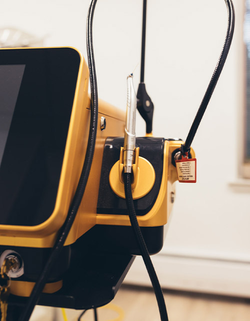 Laser-Assisted Endodontics Livingston, NJ | Liv Endodontics